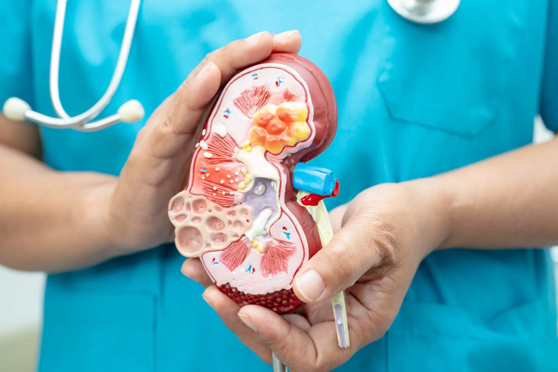 Böbrek hastalığı, Kronik böbrek hastalığı ckd, Doktor modeli tutar