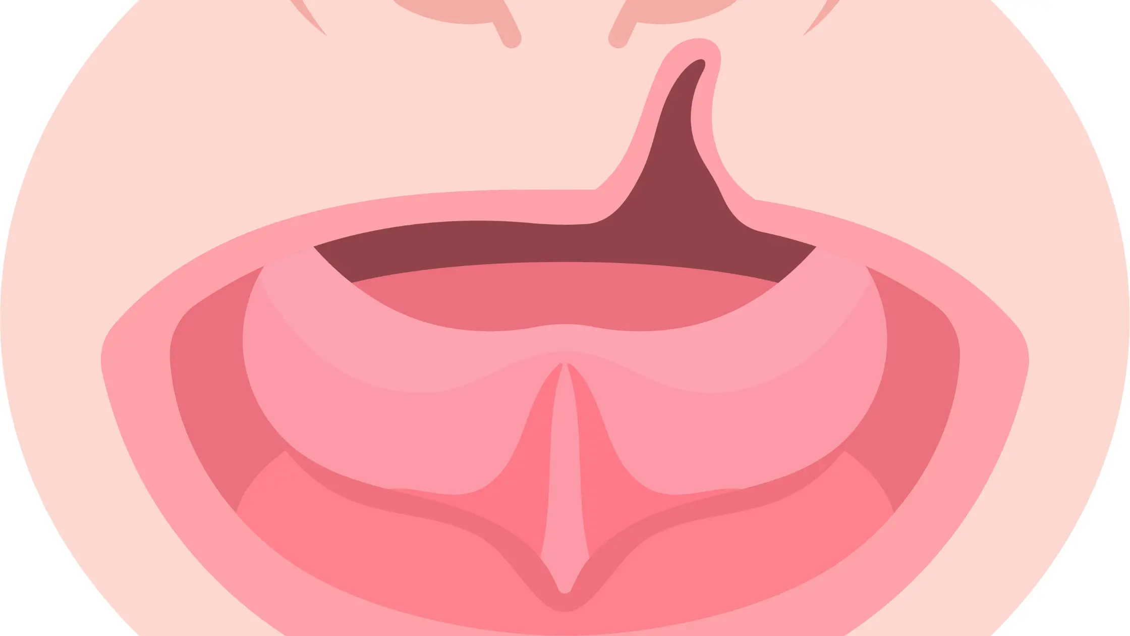 Yarık Damak Cerrahisi: Kapsamlı Rehber