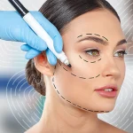 Yüz ve Boyun Germe Ameliyatı Nedir