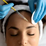 Yüze Yağ Enjeksiyonu (Otolog Yağ Grefti) Nedir